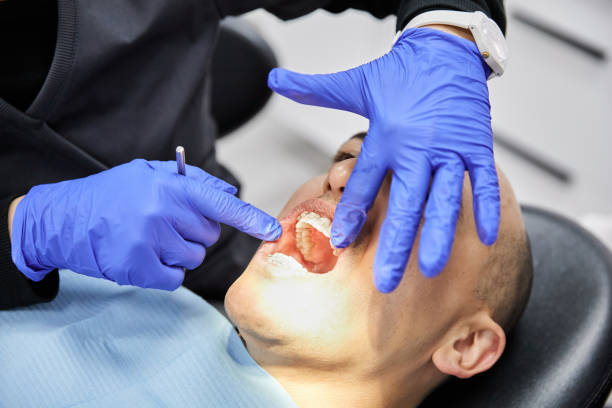 Best Emergency Gum Treatment in Sutter, CA